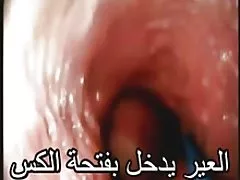 Free deutsche pornos ne (zadovoljna) gazdarica serbain-srpski durch krmanjonac