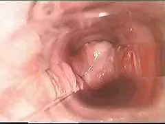 nervös kostenlos sexfilme ansehen Französisch Reife Bedürfnisse Entspannung