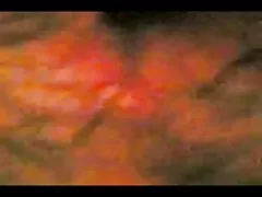 Kostenlose frauenpornos grosse klitoris zusammenstellung